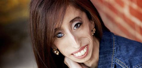 Chamada de a mulher mais feia do mundo conheça Lizzie Velasquez