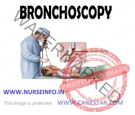 Bronchoscopy Nurse Info