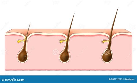 Hair Growth Cross Section Of A Human Skin With Hair Follicles Stock