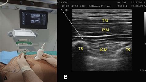 Ultrasound Positioning