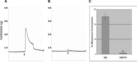 Effect Of Tetrodotoxin TTX 1 UM On Electrical FS Induced Contraction