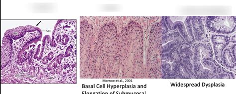 Esophagus Histology The Best Porn Website