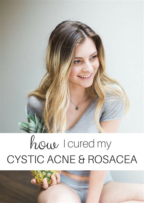 How I Cured My Cystic Acne And Rosacea The Pure Life