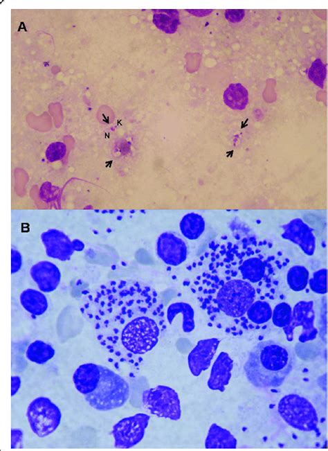 Interpretation Of Cytology A Interpretation Of Cytology Requires Time Download Scientific