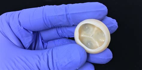 Revolutionary 3d Printing Development Heart Valves