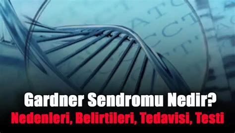 Gardner Sendromu Nedir Nedenleri Belirtileri Tedavisi Testi Fit