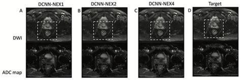 Bioengineering Special Issue Ai In Mri Frontiers And Applications