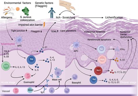 Frontiers The Immunological And Structural Epidermal Barrier