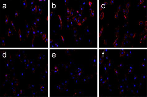 Corrosion Behavior And Cytocompatibility Of A Co Cr And Two Ni Cr