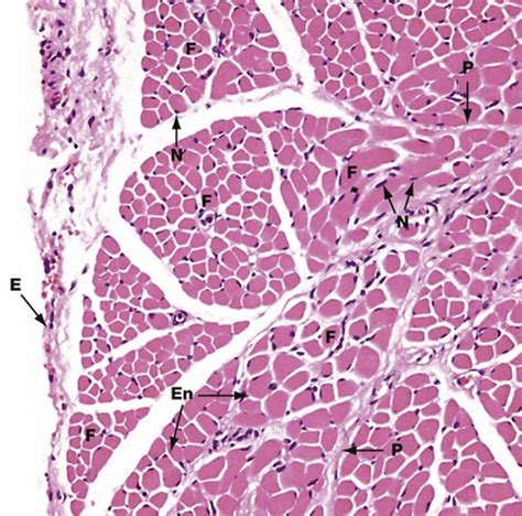 Skeletal Muscle Cross Section Diagram Quizlet