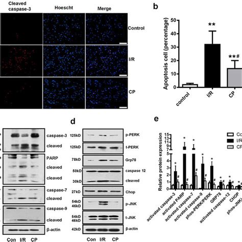 Cst Protected Against Er Stress Induced Apoptosis Via Erk And Pi K