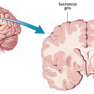 Que Es La Sustancia Gris Y Blanca Del Cerebro Sale Forodelasartes