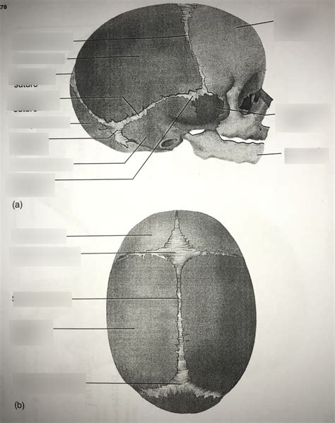 Fetal Skull Diagram Quizlet