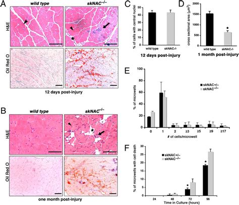 Regeneration Defects Of Skeletal Muscle In SkNAC Mice A H E