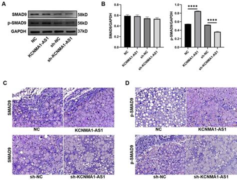 Kcnma As Activates The Smad Signaling Pathway When Hbmscs Undergo