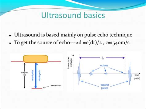 Ppt Angiography Powerpoint Presentation Free Download Id 5177574