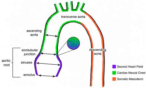 Aortic Sinus