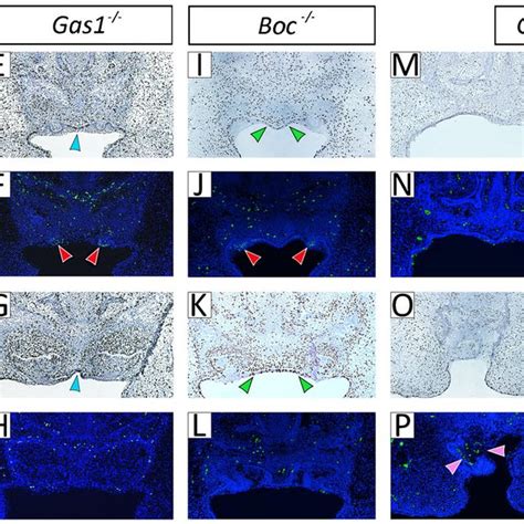 Reduced Shh Signaling In The Craniofacial Midline In The Absence Of