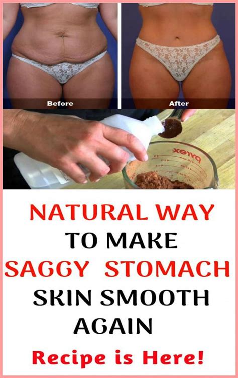 What Does Saggy Stomach Tighten Mean With Images Skin Tightening