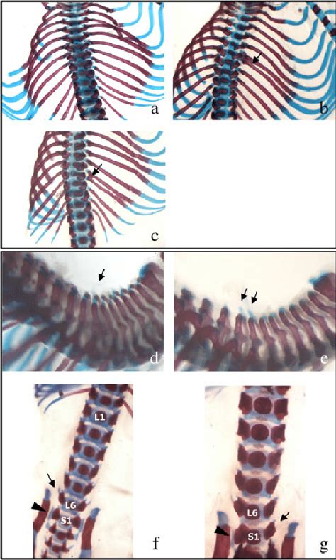 Ac Dorsal View Of The Thoracic Region Of Foetuses Double Stained For