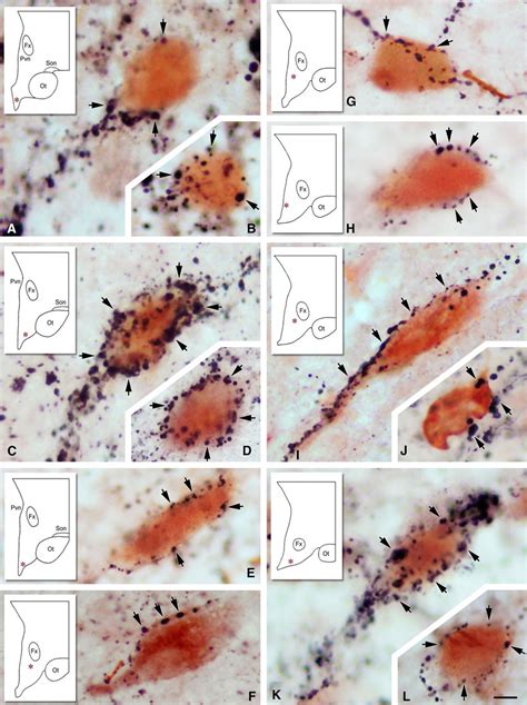 Double Label Immunohistochemistry Illustrates Juxtapositions Between