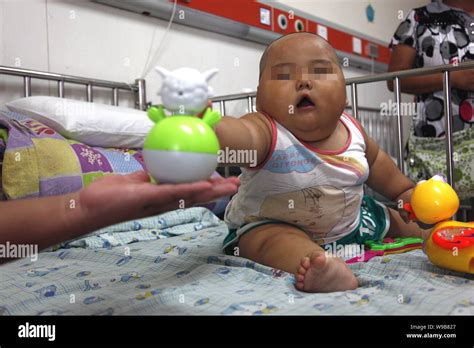 A 10 Month Old Baby Boy Who Weighs 20 Kilos 44 Lbs Plays At A