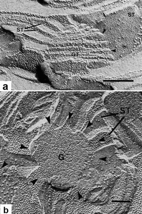 Freeze Fracture Electron Micrographs Illustrating The 3d Relationship