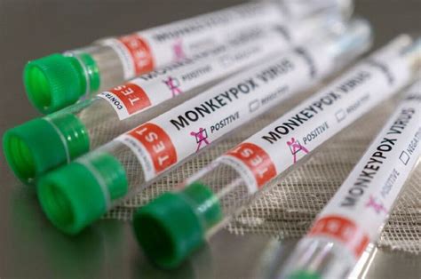 Monkeypox Casos Confirmados Em Portugal Healthnews