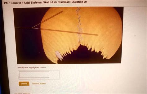 Solved Pal Cadaver Axial Skeleton Skull Lab Practical Question