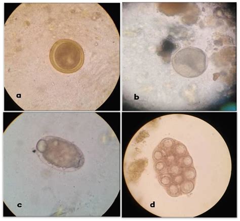 Types Of Eggs In Fecal Examination A Toxocara Canis Egg X40 Showed