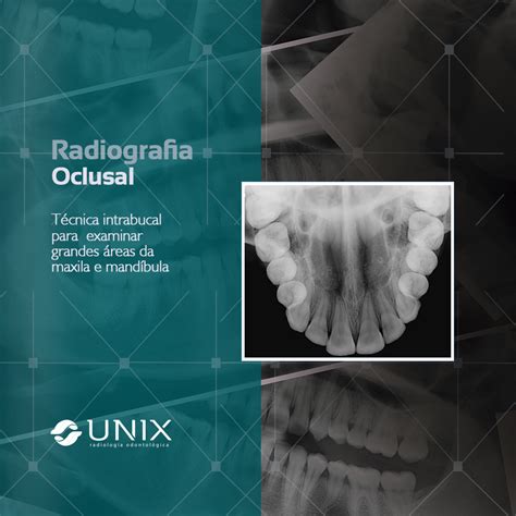 Radiografia Oclusal Unix