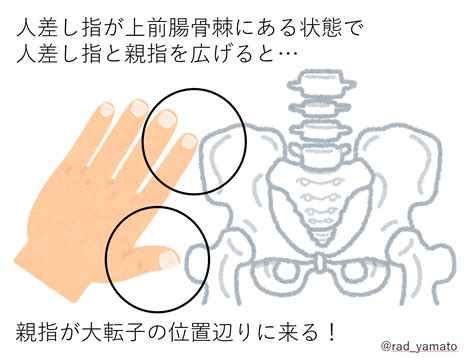 X線撮影｜腹部レントゲンの撮り方 放射線技師ヤマトのブログ