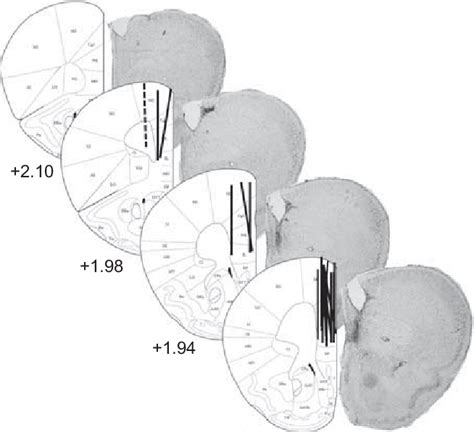 Histological Verification Of Cannula Placements In The Right