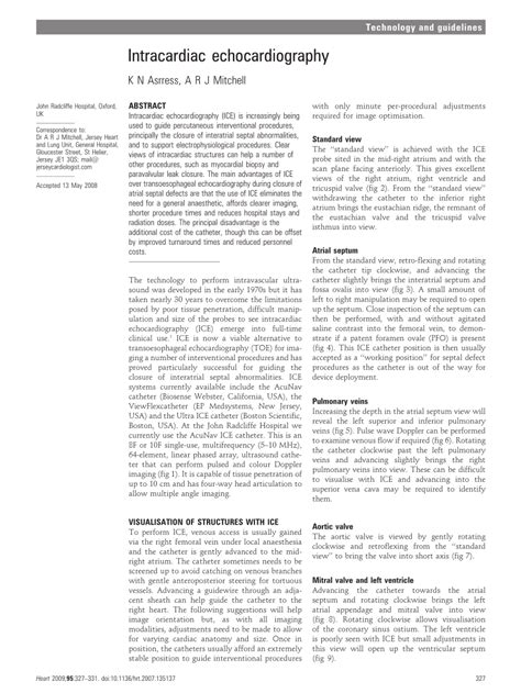 (PDF) Intracardiac echocardiography