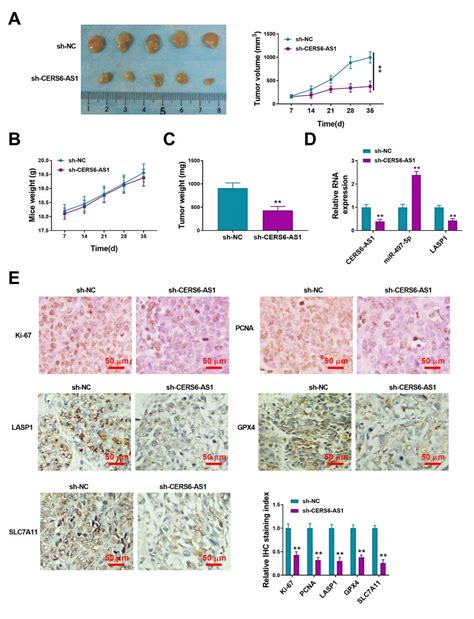 CERS6 AS1 Facilitates Oncogenesis And Restrains Ferroptosis In