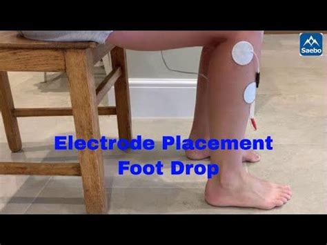 Electrode Placement For Foot Drop Youtube Tens Unit Placement Tens