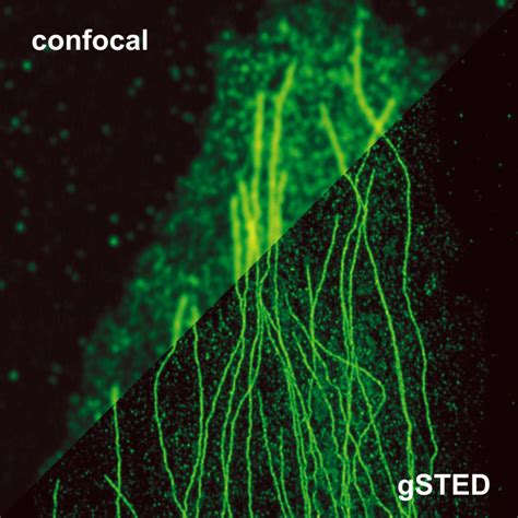 Stimulated Emission Depletion Microscopy STED PicoQuant