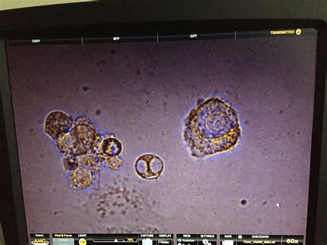 Interpretation of Microscopic picture of MCF cell lines? | ResearchGate