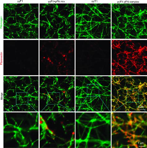 Confocal Microscopy Fibrin Matrices Made From F F Mixture