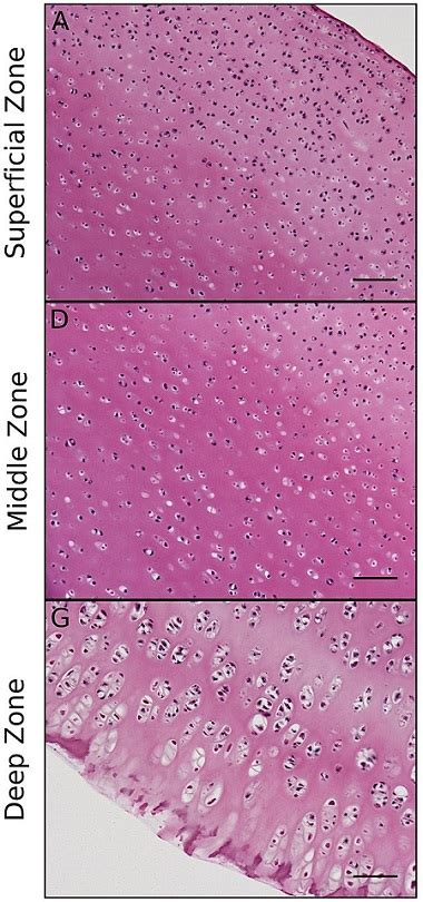 What Is Cartilage Types Function And Location Video And Lesson Transcript