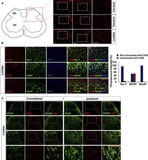 Reversible Induction Of Pain Hypersensitivity Following Optogenetic