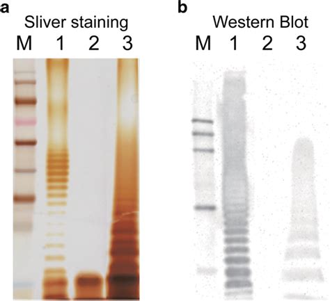 SDS PAGE Silver Staining And Western Blotting Analysis Of LPS The