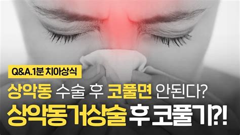 상악동거상술 수술 후 코풀기 언제부터 가능 상악동임플란트 후 주의사항 ⏰1분 치아상식 꿀팁 Youtube