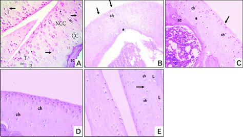 Hematoxylin And Eosin H E Stained Sections Of Articular Cartilage Of