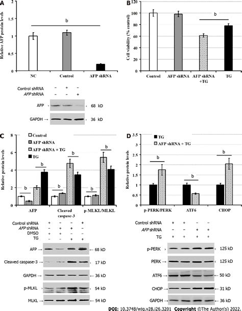 Figure 1 From Intracellular Alpha Fetoprotein Mitigates Hepatocyte