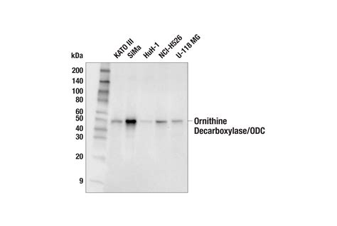 Ornithine Decarboxylase ODC E5Q5U Rabbit MAb Cell Signaling Technology