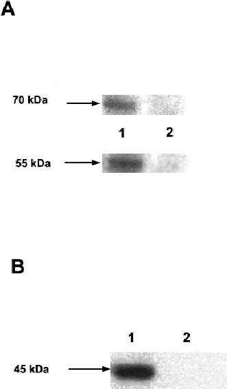 Creatine Transporter A And Mitochondrial Creatine Kinase B Protein Download Scientific