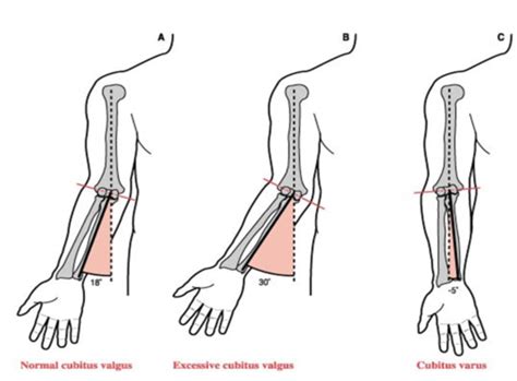 Kinesiology Elbow Forearm 12 Flashcards Quizlet