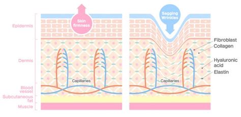 Skin layers | Skin, Skincare, Layers