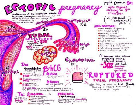 emDOCs.net – Emergency Medicine EducationOBCast: Ectopic Pregnancy ...